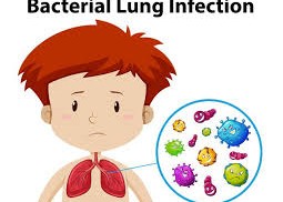 Understanding Bacterial Infections of the Respiratory System